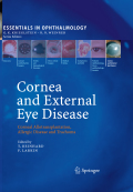 Cornea and external eye disease: corneal allotransplantation, allergic disease and trachoma