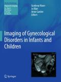 Imaging of gynecological disorders in infants andchildren