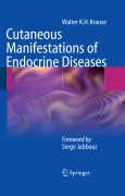 Cutaneous manifestations of endocrine diseases