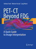 PET-CT beyond FDG: a quick guide to image interpretation