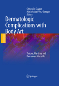 Dermatologic complications with body art: tattoos, piercings and permanent make-up