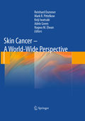 Skin cancer: a world-wide perspective