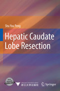 Hepatic caudate lobe resection