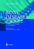 Bone diseases: macroscopic, histological, and radiological diagnosis of structural changes in the skeleton