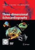 Three-dimensional echocardiography
