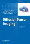 Diffusion tensor imaging: introduction and atlas