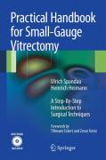 Practical handbook for small-gauge vitrectomy: a step-by-step introduction to surgical techniques