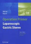 Laparoscopic gastric sleeve