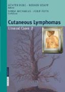 Cutaneous lymphomas: unusual cases 2
