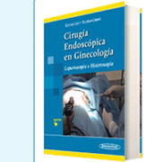 Cirugía endoscópica en ginecología: laparoscopia e histeroscopia