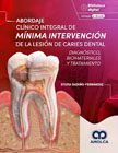 Abordaje clínico integral de mínima intervención de la lesión de caries dental: Diagnóstico, biomateriales y tratamiento