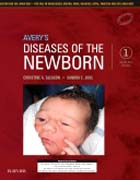 Averys Diseases of the Newborn: First South Asia Edition