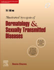 Illustrated Synopsis of Dermatology & Sexually Transmitted Diseases