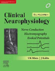 Clinical Neurophysiology: Nerve Conduction, Electromyography, Evoked Potentials