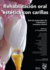 Rehabilitación oral estética con carillas: guía de preparación del tratamiento y conceptos clínicos