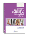 Abordaje de edemas y úlceras de extremidad inferior