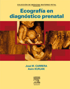 Ecografía en diagnóstico prenatal