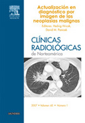 Clínicas radiológicas de Norteamérica 2007 n. 1 Actualización en diagnóstico por imagen de las neoplasias malignas