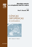 Clínicas ortopédicas de Norteamérica 2009 v. 40 n. 3 Abordaje anterior en artroplastia total de cadera