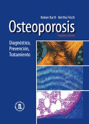 Osteoporosis: diagnóstico, prevención, tratamiento