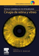 Cirugía de retina y vítreo