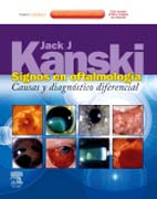 Signos de oftalmología: causas y diagnóstico diferencial