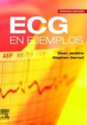 ECG en ejemplos