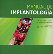 Manual de implantología