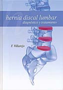 Hernia discal lumbar: diagnóstico y tratamiento