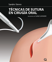 Técnicas de sutura en cirugía oral