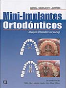 Mini-implantes ortodónticos: concpetos innovadores de anclaje