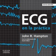 ECG en la práctica