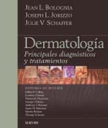 Dermatología: Principales diagnósticos y tratamientos