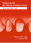 Restauración del diente endodonciado