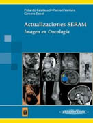 Actualizaciones SERAM: imagen en oncología