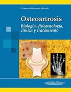 Osteoartrosis: biología, fisiopatología, clínica y tratamiento