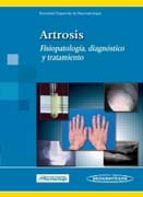 Artrosis: fisiopatología, diagnóstico y tratamiento