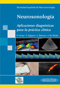 Neurosonología: aplicaciones diagnósticas para la práctica clínica