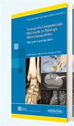 Tomografía computarizada multicorte en patología musculoesquelética