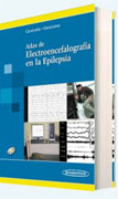 Atlas de electroencefalografía en la epilepsia