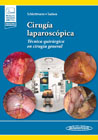 Cirugía laparoscópica: Técnica quirúrgica en cirugía general