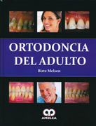 Ortodoncia del Adulto