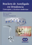 Brackets de Autoligado en Ortodoncia